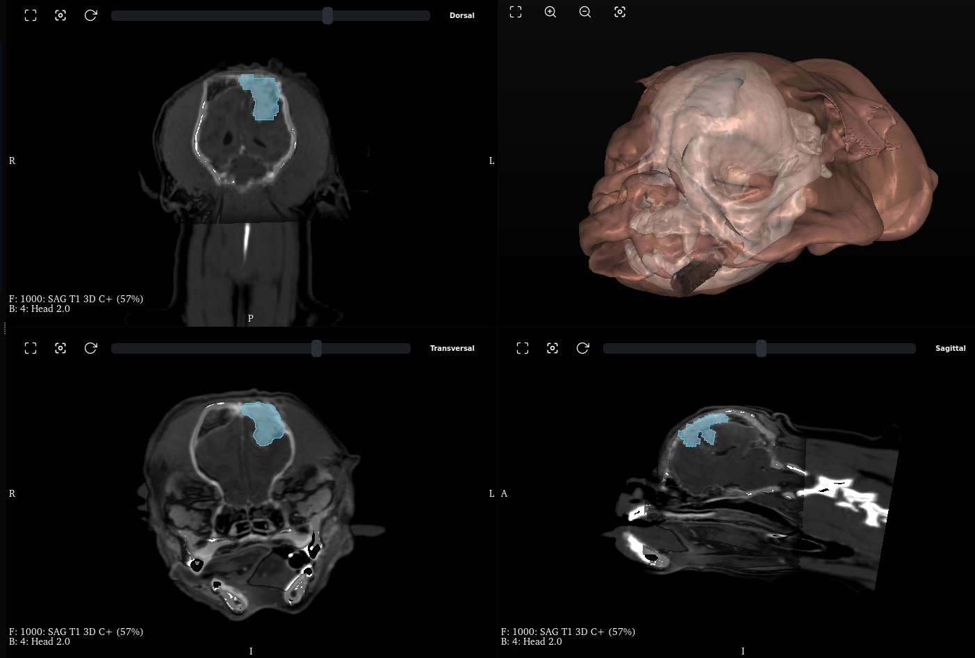 Orion One — Módulo Brain