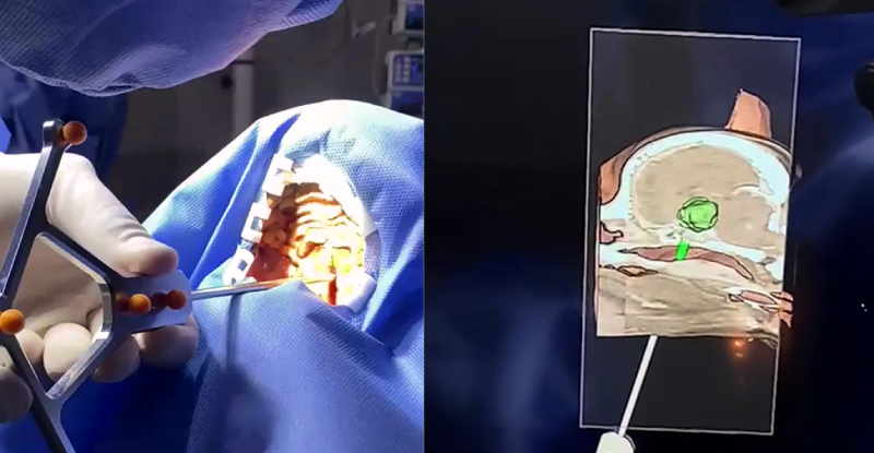Neuronavegador Veterinário Orion One em uma mesa cirúrgica