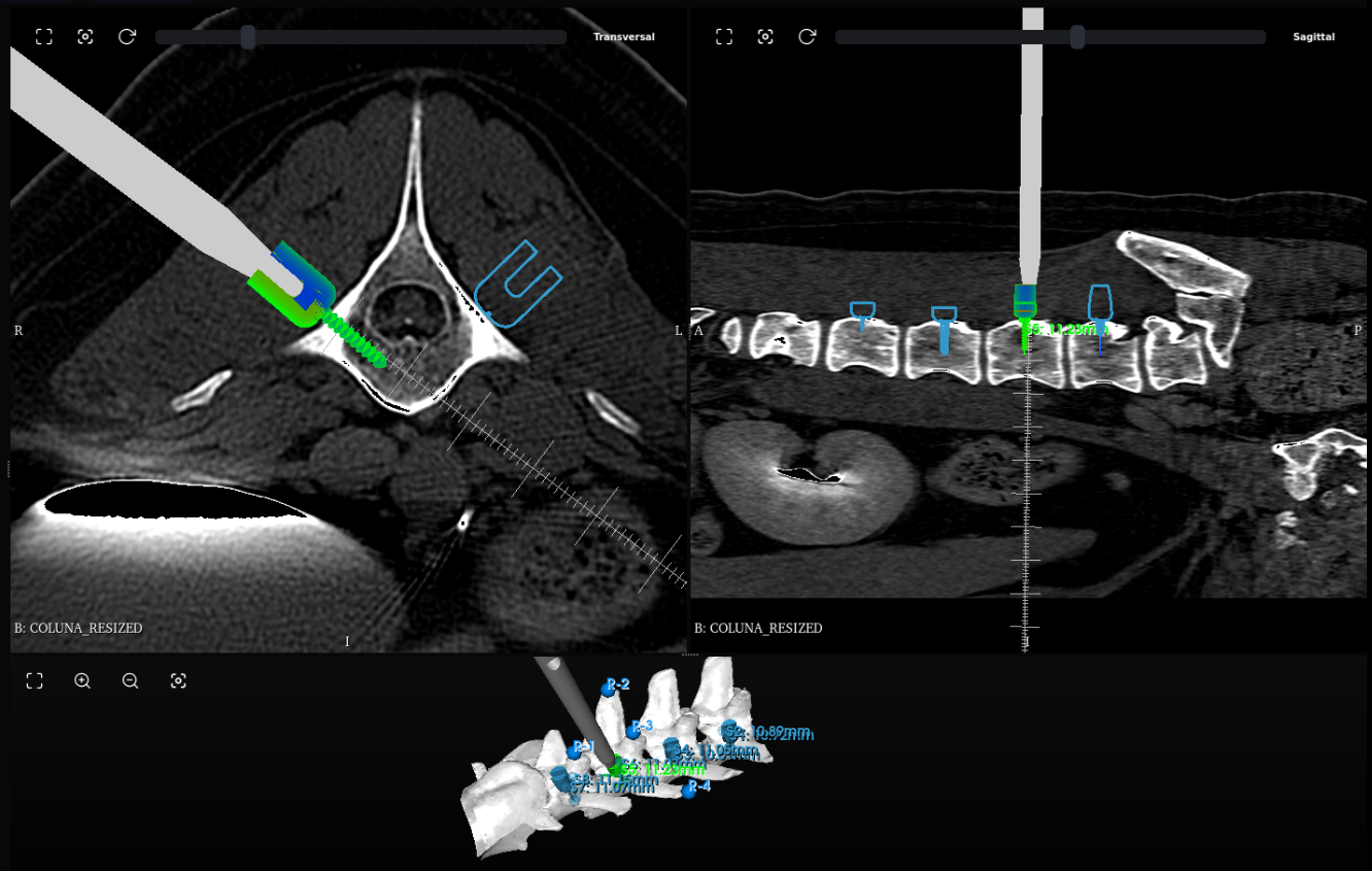 Orion One — Módulo Spine